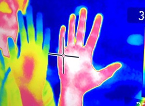 A thermogram comparing a cold hand and a warm hand